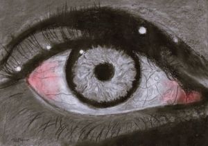 Voir le détail de cette oeuvre: Coup de sang dans l'œil
